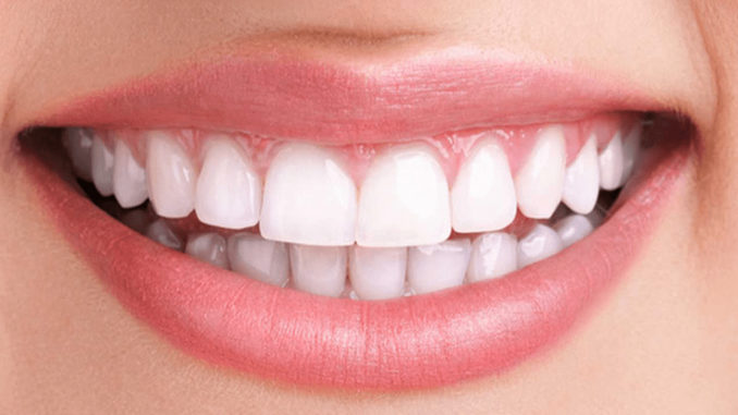 www.criticalmatters.net.news.article.zine__2022__teeth-whitening